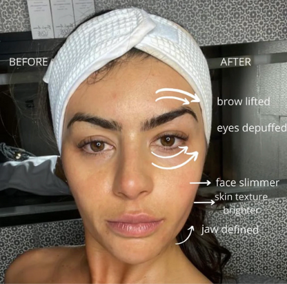 Brissea™ Lymphatic Brush